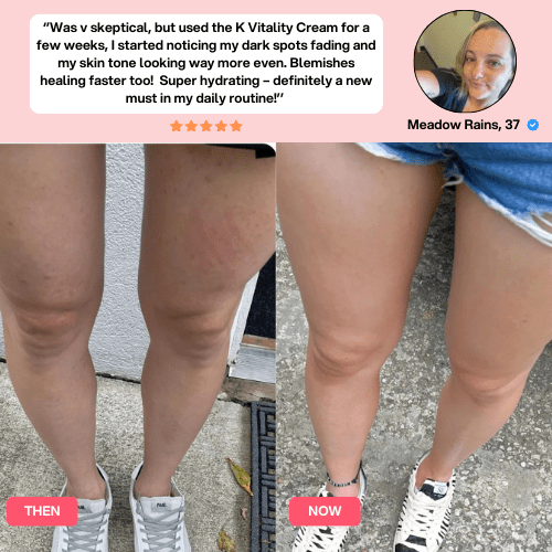 Anti-Cellulite Massager Set