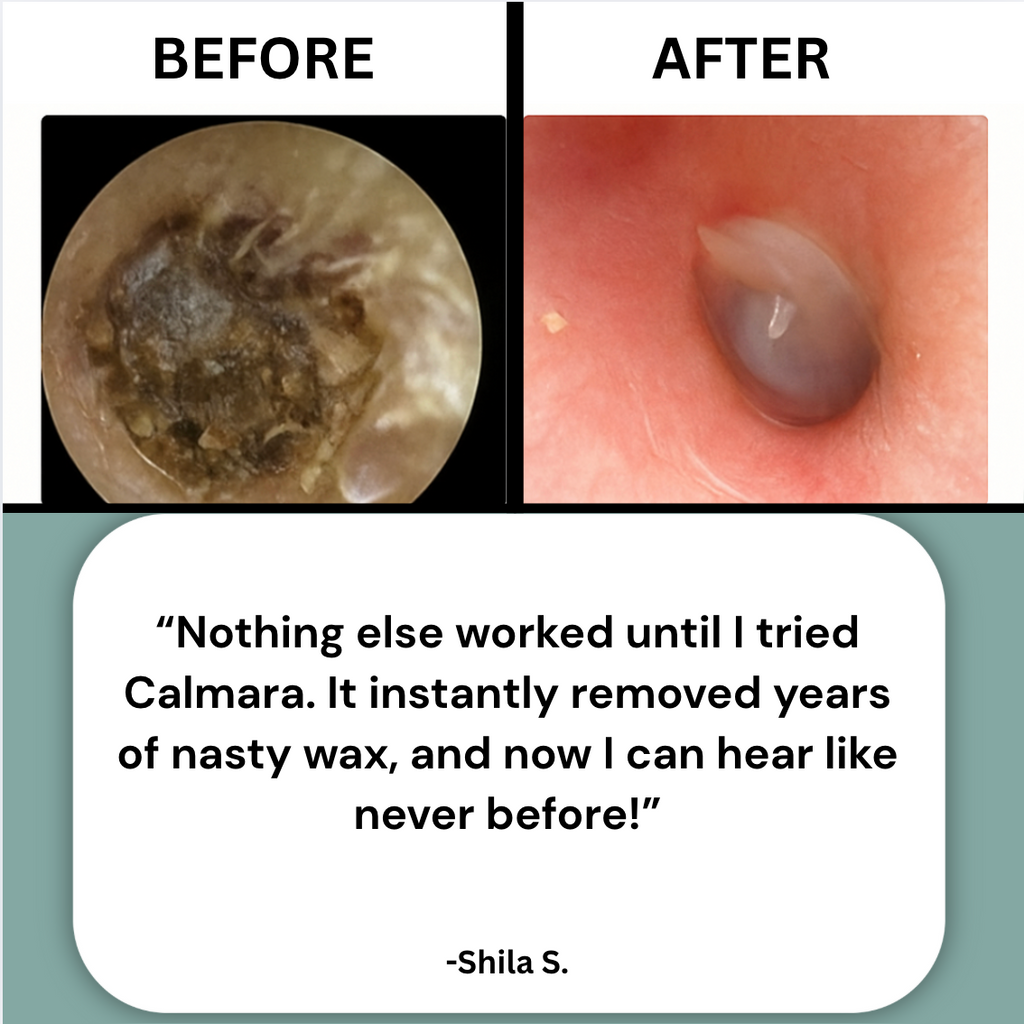 Ear Wax Remover
