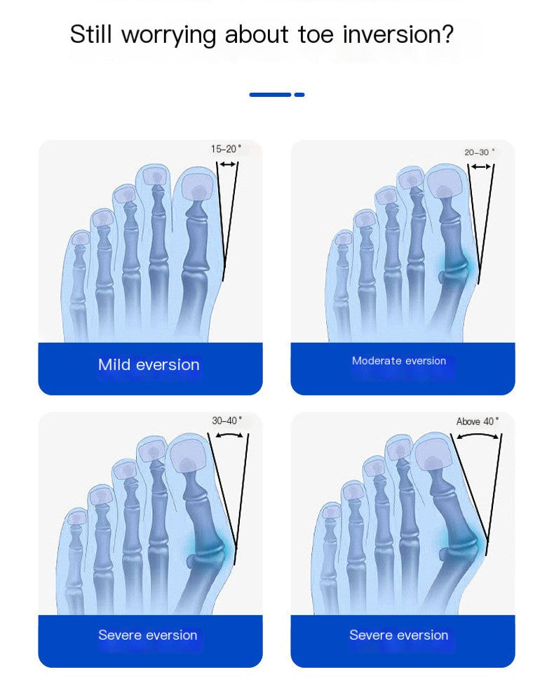 Bunion Corrector 2.0